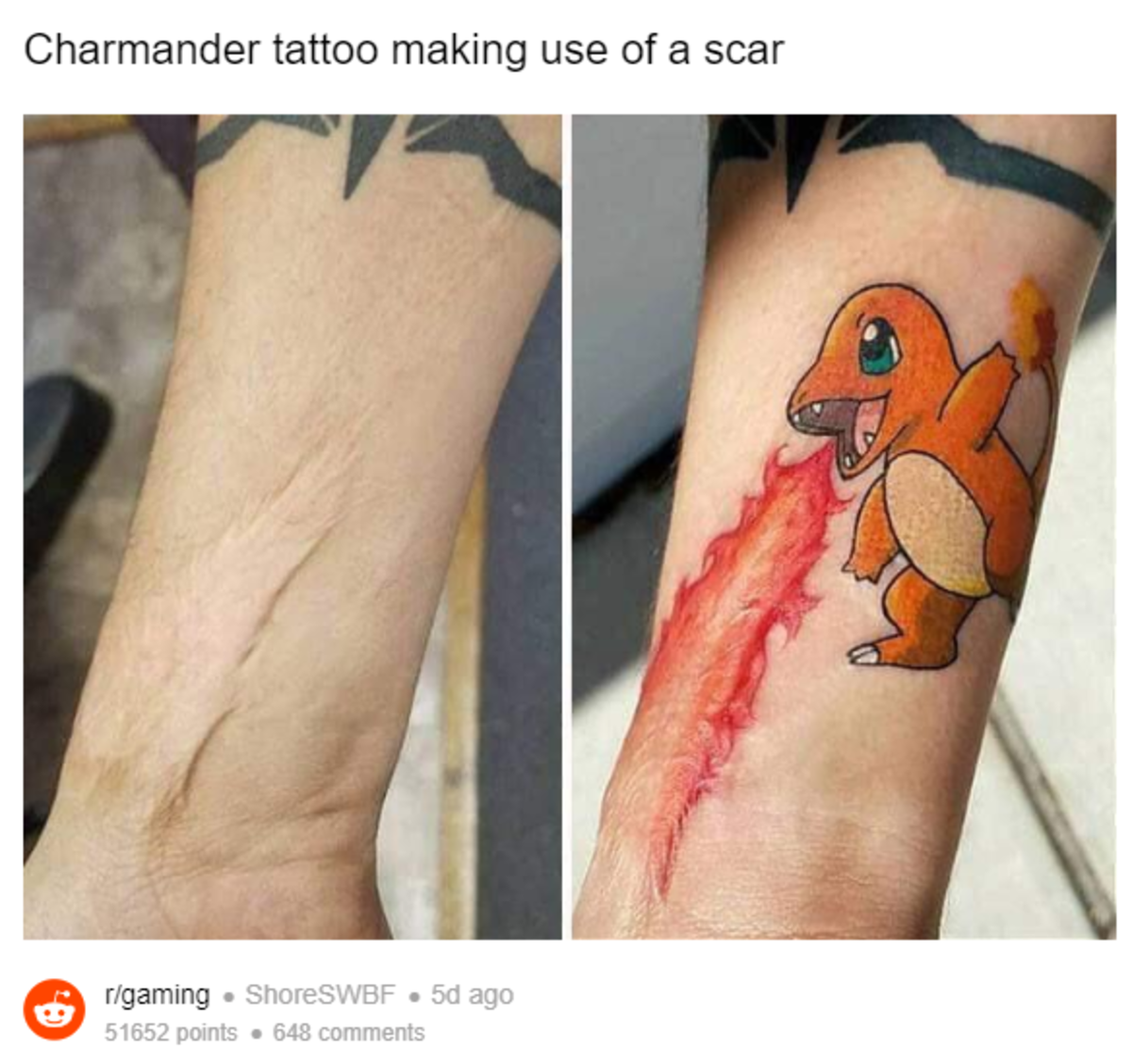 Un aficionado utiliza la cicatriz de su brazo para hacerse un genial tatuaje de Charmander